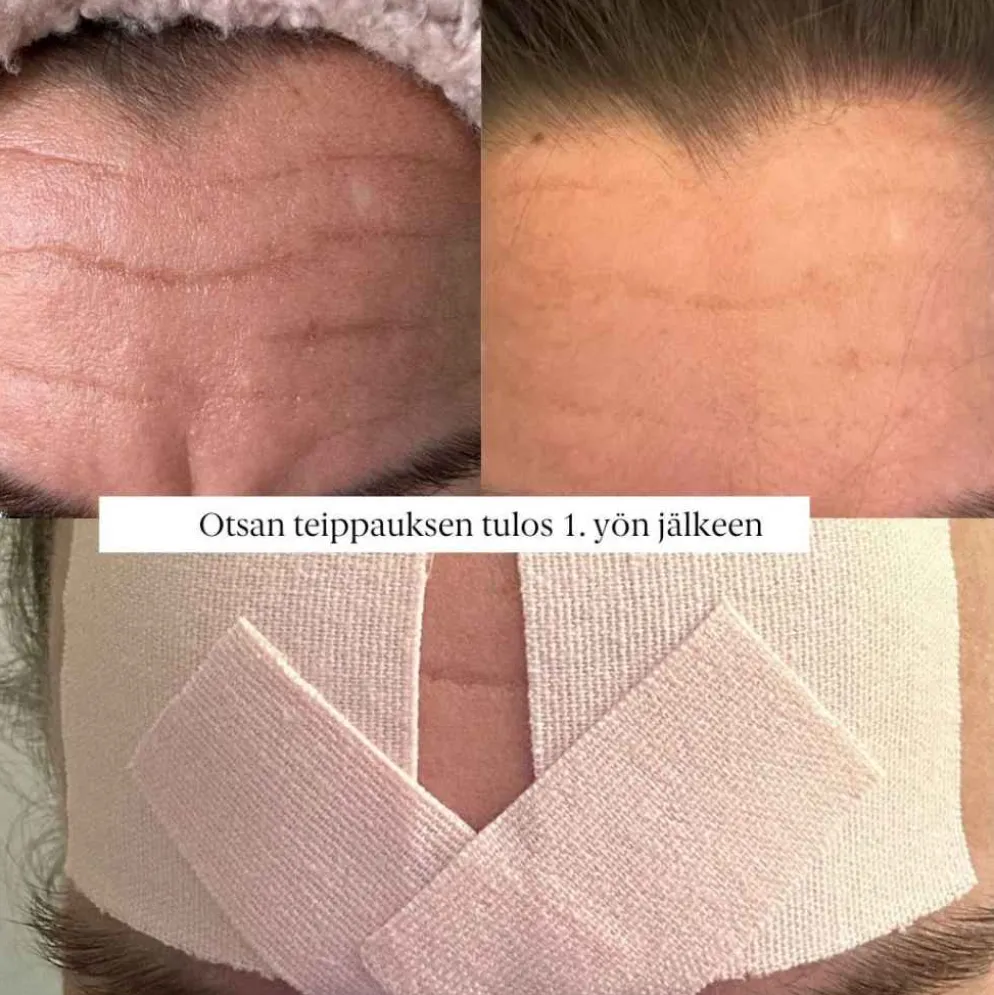 Faceimage kinesioteippi herkälle iholle, 2 eri kokoa