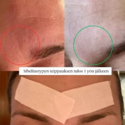 Faceimage kinesioteippi kasvoille Regular, 2 eri kokoa