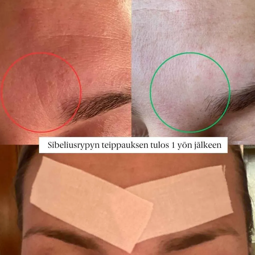 Faceimage kinesioteippi kasvoille Regular, 2 eri kokoa