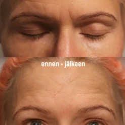 Faceimage kinesioteippi kasvoille Regular, 2 eri kokoa