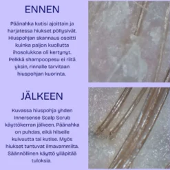 Hiuspohjan analyysi