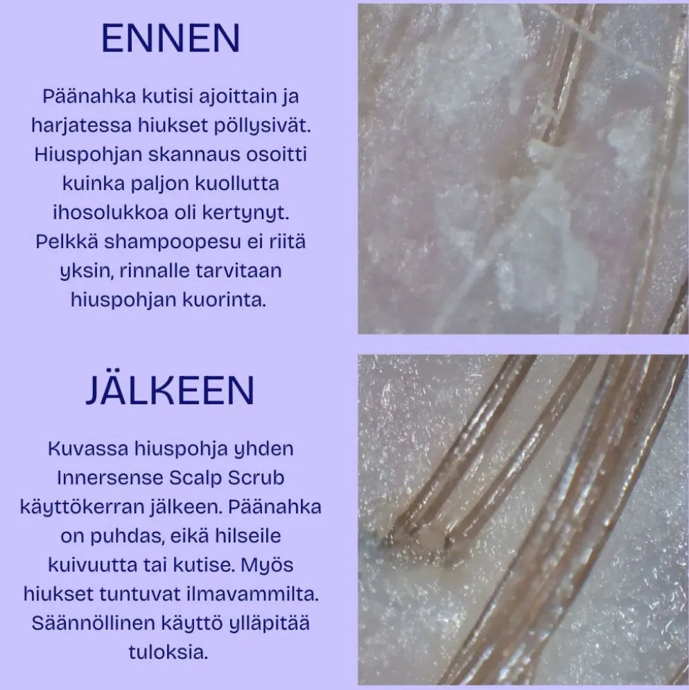 Hiuspohjan analyysi