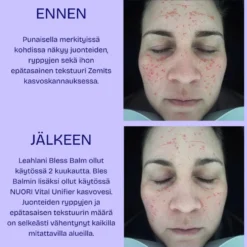 Kosteuttava kasvovesi NUORI Vital Unifier, 2 kokoa