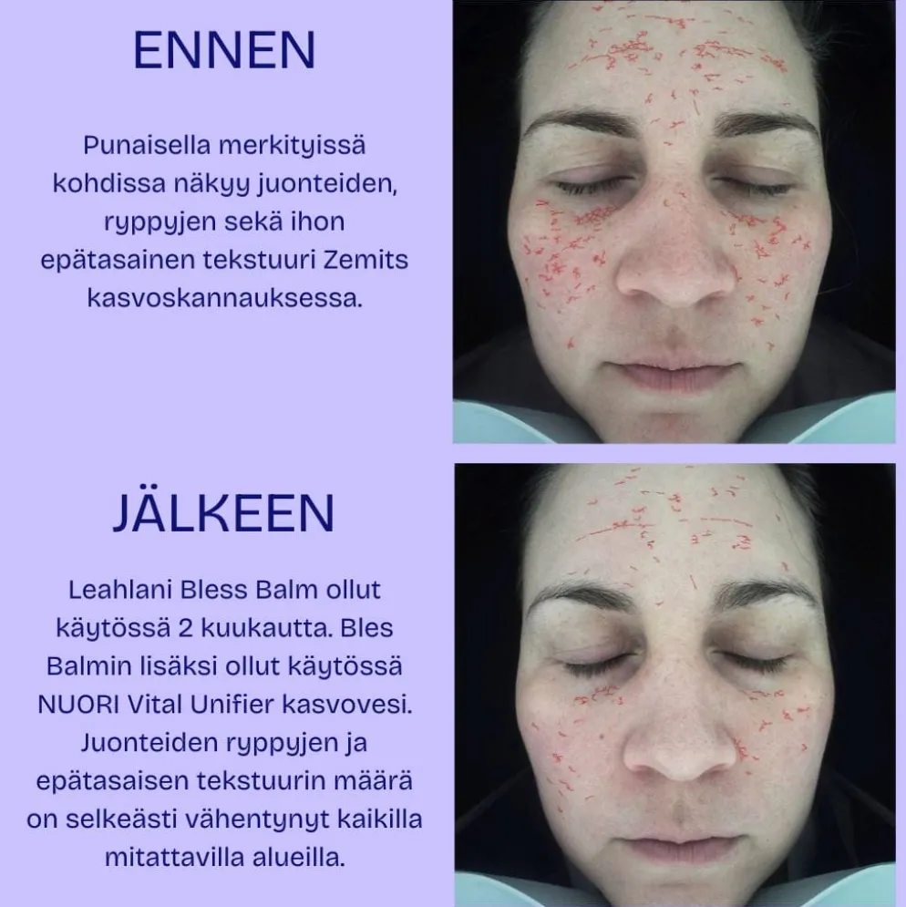 Kosteuttava kasvovesi NUORI Vital Unifier, 2 kokoa