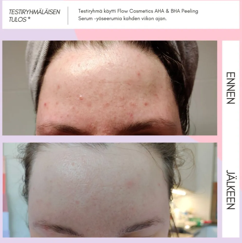 Seerumi Flow Cosmetics AHA & BHA Peeling Serum, 2 kokoa