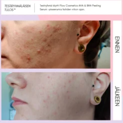 Seerumi Flow Cosmetics AHA & BHA Peeling Serum, 2 kokoa