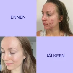 Twistbe Jojoba-teepuu kasvoöljy 30ml