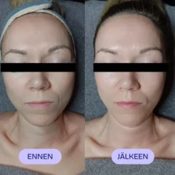 Yin Your Skin® Pro Gua Sha kasvohoito 90min